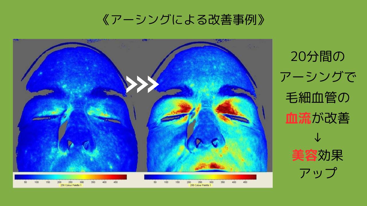 アーシングによる改善事例…美容